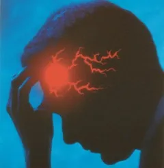 مختصری راجع به میگرن
