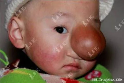 پسر بچه ای شبیه پینوکیو