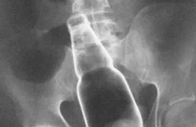 ماجرای عجیب پزشکی