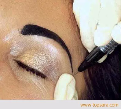 راه های پاک کردن تاتو