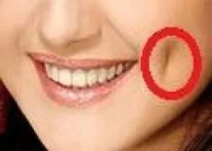 یک جراحی زیبایی عجیب و نوظهور در ایران