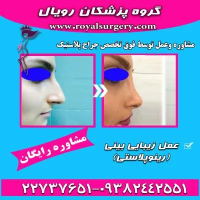جراحی بینی