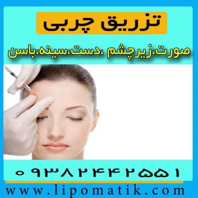 تزریق چربی