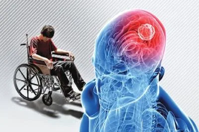 «ام اس» در کمین ایرانی‌ها بخاطر کمبود یک ویتامین