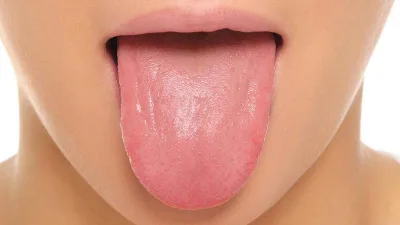 سرطان زبان، به زبان ساده