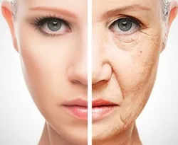 رفع چین و چروک پوست با بوتاکس گیاهی