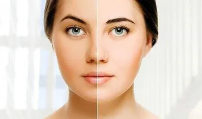 توصیه طب سنتی برای روشن شدن پوست