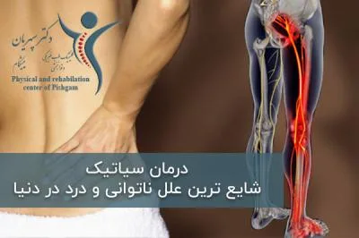 درمان سیاتیک ؛ شایع ترین علل ناتوانی و درد در دنیا