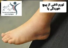 پیچ خوردگی مچ پا را جدی بگیرید