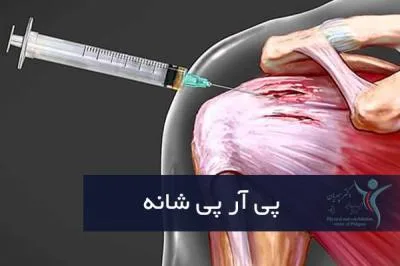 پی آر پی شانه
