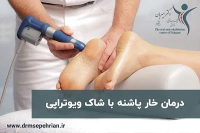 درمان خار پاشنه با شاک ویوتراپی