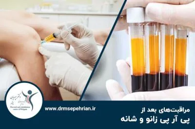 مراقبت‌های بعد از پی آر پی زانو و شانه