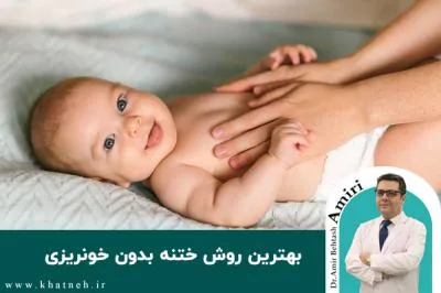 بهترین روش ختنه بدون خونریزی چیست؟