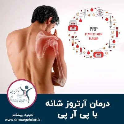 درمان آرتروز شانه با پی آر پی