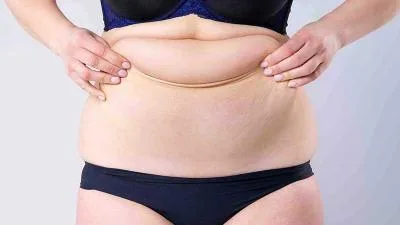 لیپوماتیک یا  Power Assisted Liposuction (PAL)