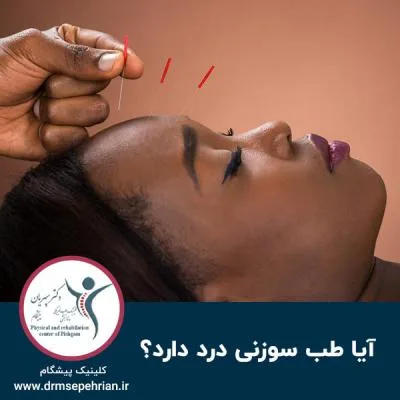 آیا طب سوزنی درد دارد؟