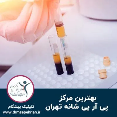 بهترین مرکز پی آر پی شانه تهران