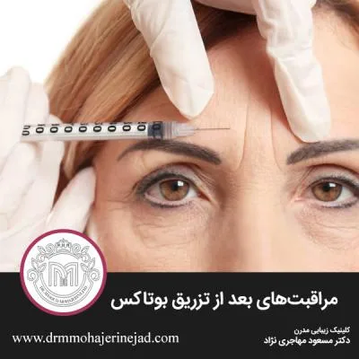 مراقبت‌های بعد از تزریق بوتاکس
