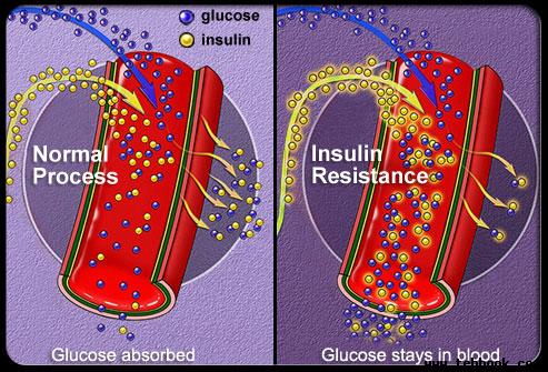 type2diabetes-s3-insulin-absorption