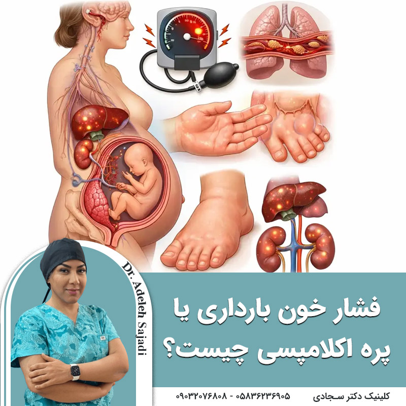  فشار خون بارداری یا پره اکلامپسی چیست؟