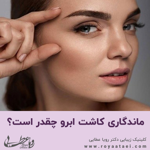  ماندگاری کاشت ابرو چقدر است؟