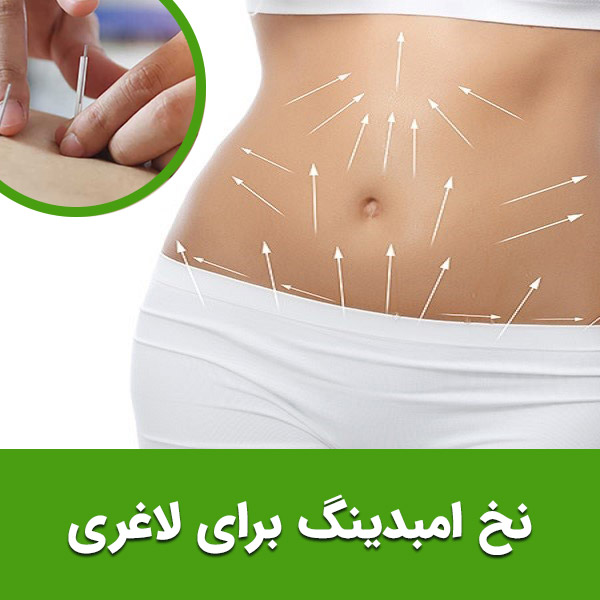  نخ امبدینگ برای لاغری