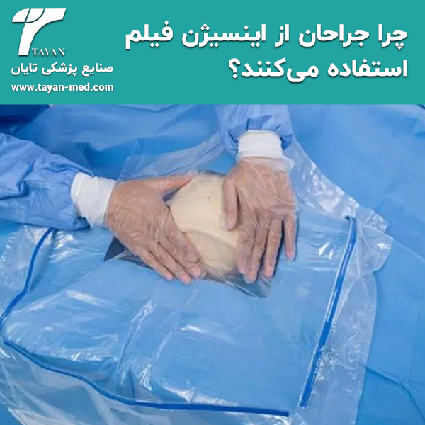  چرا جراحان از اینسیژن فیلم استفاده می‌کنند؟