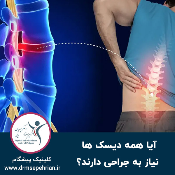  آیا همه دیسک ها نیاز به جراحی دارند؟
