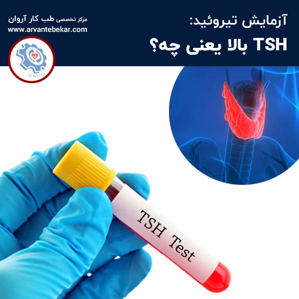  آزمایش تیروئید: TSH بالا یعنی چه؟