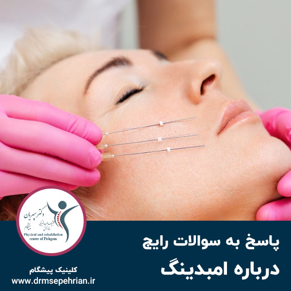  پاسخ به سوالات رایج درباره امبدینگ