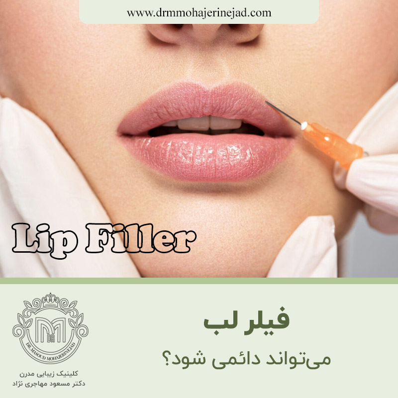  آیا فیلر لب می‌تواند دائمی شود؟
