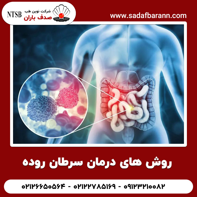  روش های درمان سرطان روده
