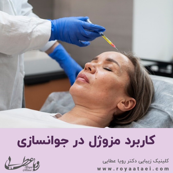  کاربرد مزوژل در جوانسازی