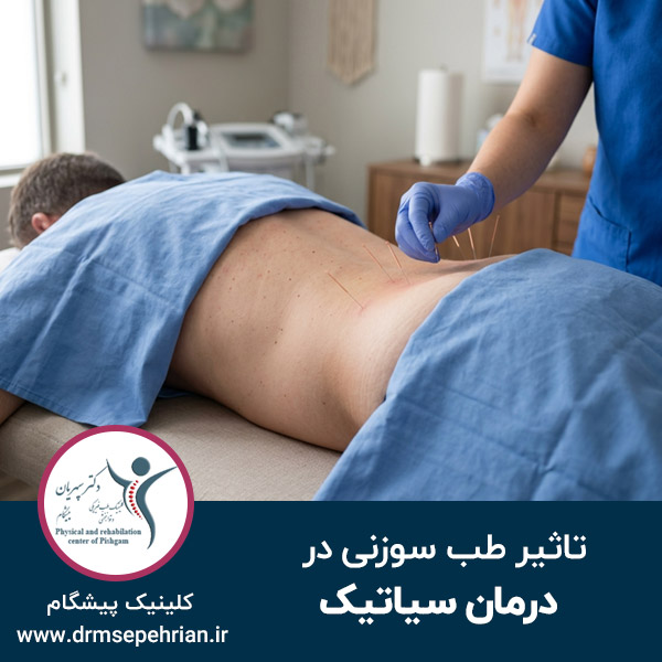  طب سوزنی در درمان سیاتیک و رهایی از دردهای عصبی مزمن