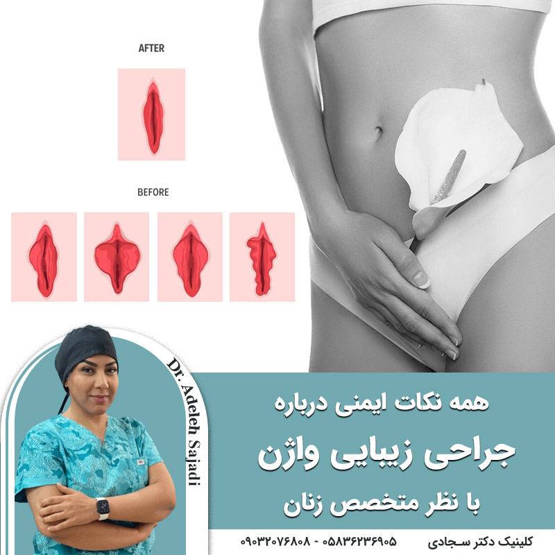  همه نکات ایمنی درباره جراحی زیبایی واژن با نظر متخصص زنان