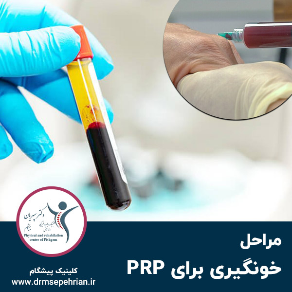  مراحل خونگیری برای PRP