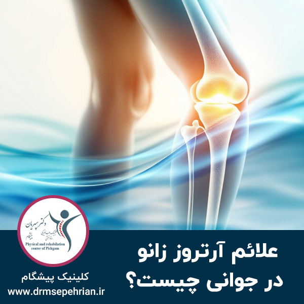  علائم آرتروز زانو در جوانی چیست؟
