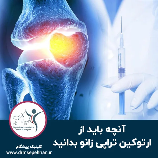 آنچه باید از ارتوکین تراپی زانو بدانید