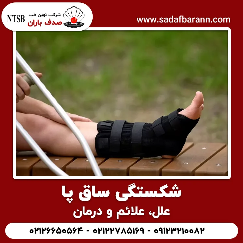 شکستگی ساق پا؛ علل، علائم و درمان