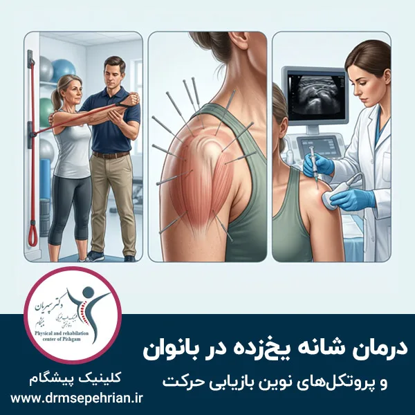 درمان شانه یخ زده در بانوان و پروتکل‌های نوین بازیابی حرکت