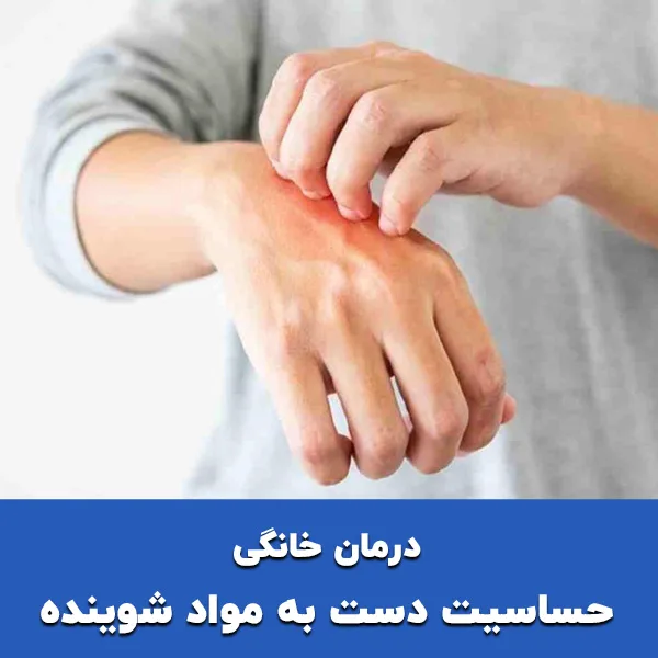 درمان خانگی حساسیت دست به مواد شوینده