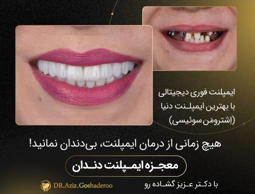 بهترین دندانپزشک تهران باید چه ویژگی‌هایی داشته باشد؟