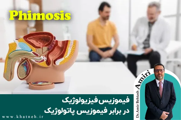 فیموزیس فیزیولوژیک در برابر فیموزیس پاتولوژیک
