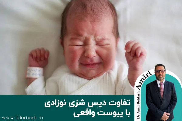 تفاوت دیس شزی نوزادی با یبوست واقعی