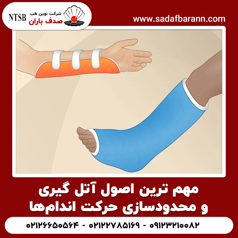 مهم ترین اصول آتل گیری و محدودسازی حرکت اندام ها
