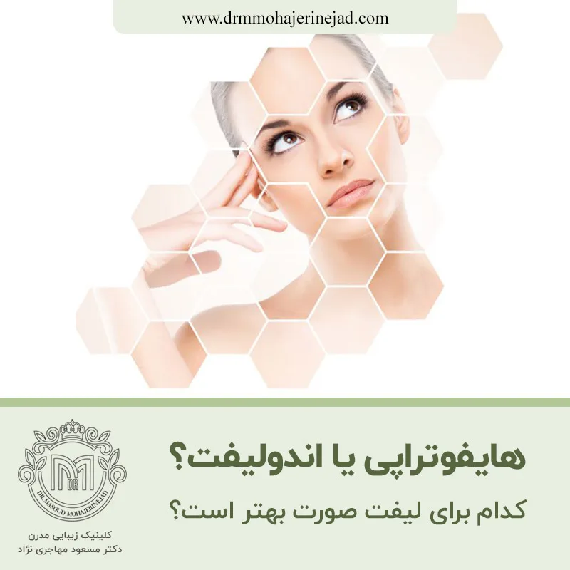 هایفوتراپی یا اندولیفت؟ کدام برای لیفت صورت بهتر است؟