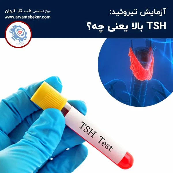آزمایش تیروئید: TSH بالا یعنی چه؟