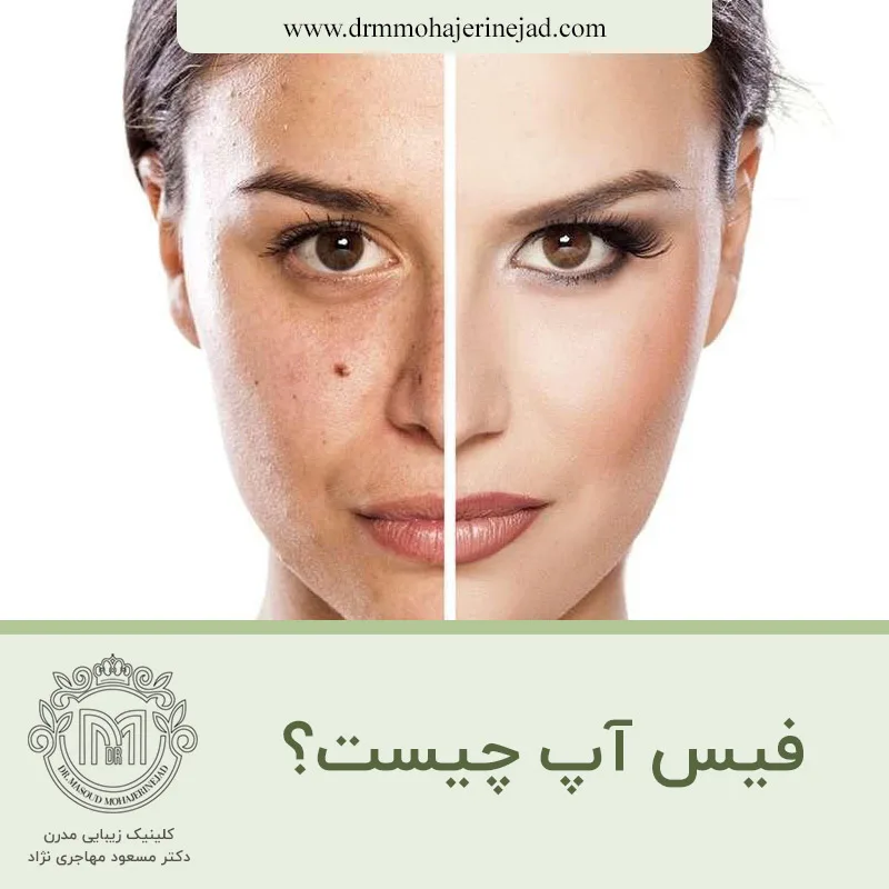 فیس آپ چیست؟