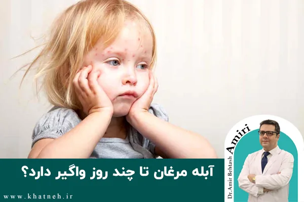 آبله مرغان تا چند روز واگیر دارد؟
