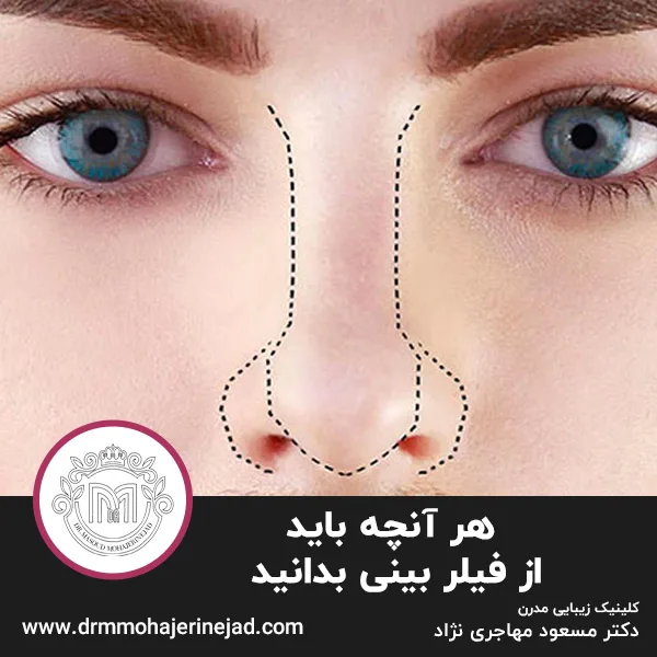 هر آنچه باید از فیلر بینی بدانید